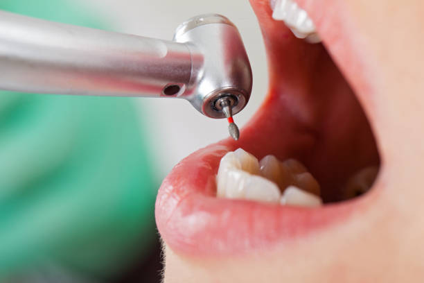 Best Emergency Denture Repair in Hanover, PA